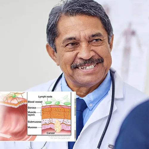 Maintaining Your Penile Implant for Long-Term Success